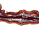 Żwacz