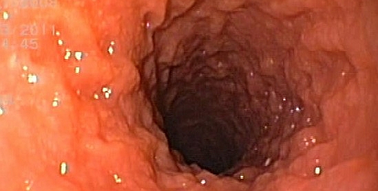 Nieswoiste zapalenia jelit u psów (NZJ, IBD - Inflammatory Bowel Disease)