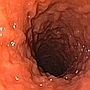 Nieswoiste zapalenia jelit u psów (NZJ, IBD - Inflammatory Bowel Disease)