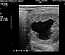 USG method for pregnancy diagnosis and monitoring in a mare.